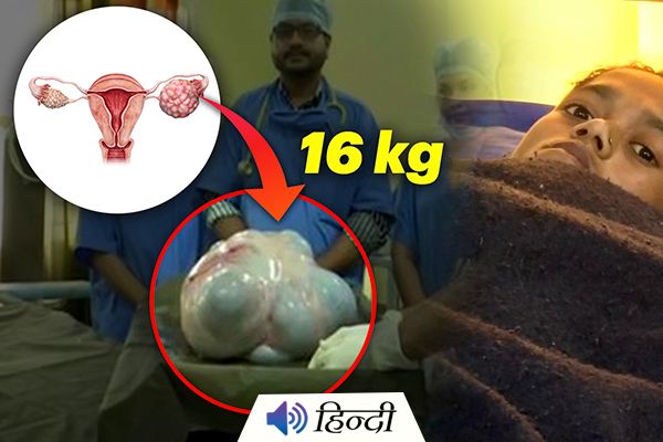 Doctors Remove 16-Kg Tumor From Woman’s Abdomen