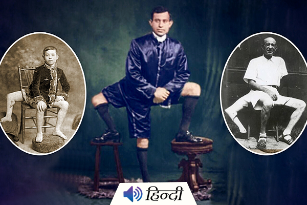 Frank Lentini: Story of the Man With Three Legs